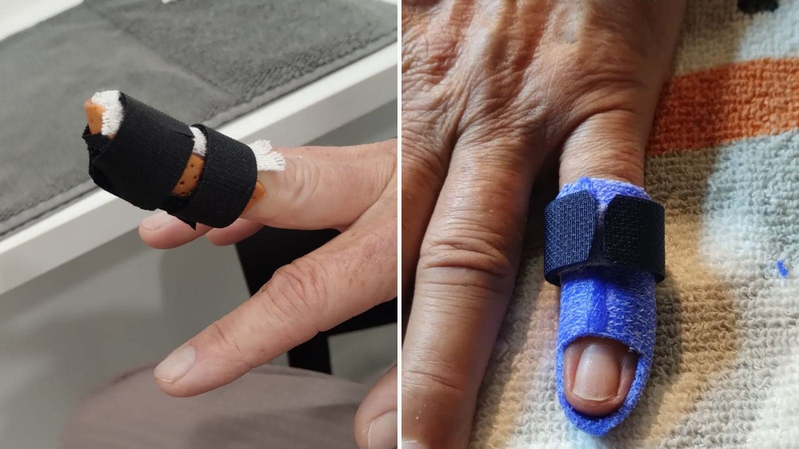 Due tutori per il dito a martello: uno arancione con fascia nera, uno blu su misura