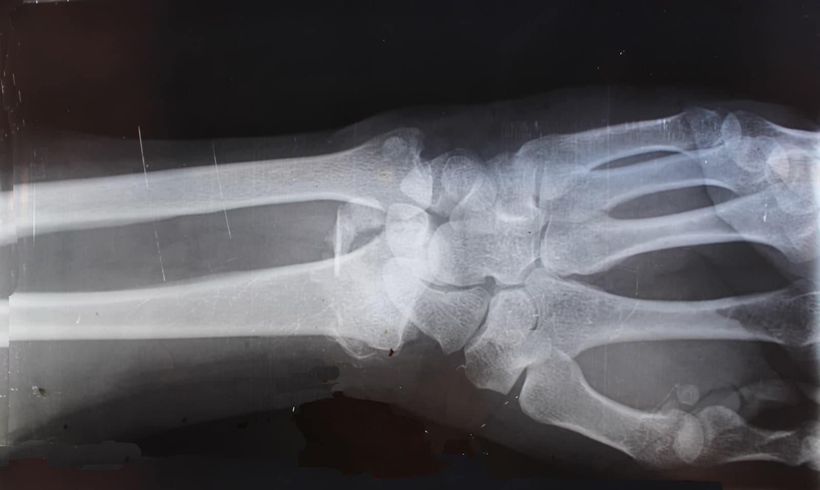 Radiografia osservata in controluce